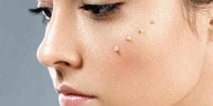 کرم CC و اجزای سازنده آن