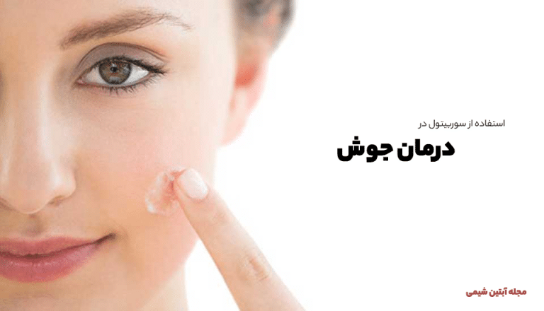 تاثیر سوربیتول در درمان جوش